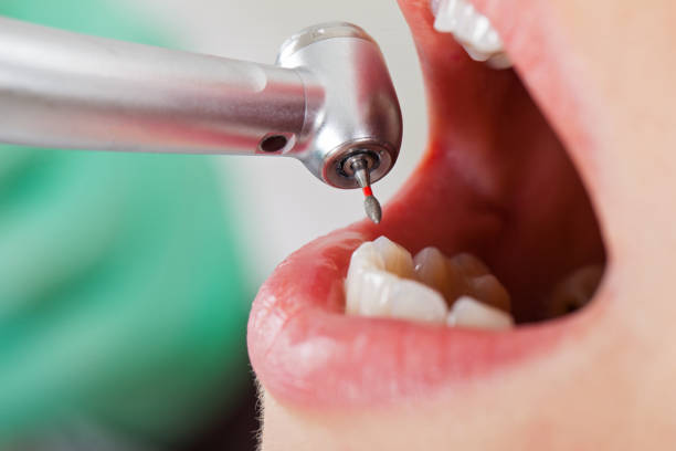 Best Emergency Root Canal Treatment in Bixby, OK